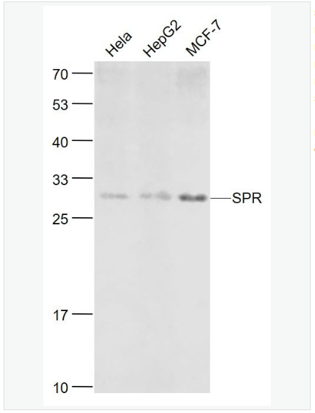 Anti-SPR  antibody-墨蝶蛉还原酶抗体,SPR