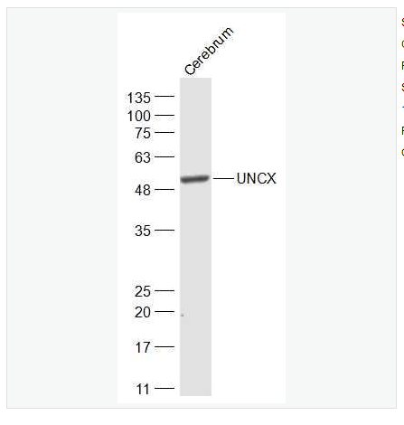 Anti-UNCX antibody-同源蛋白UNCX抗體,UNCX