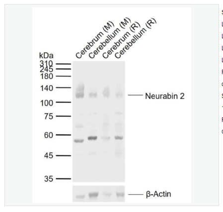 Anti-Neurabin 2  antibody-5-神經(jīng)組織特異性F肌動(dòng)蛋白結(jié)合蛋白2抗體,Neurabin 2