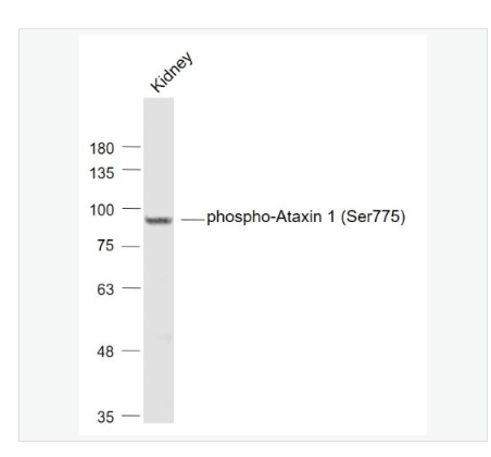 Anti-phospho-Ataxin 1 antibody-磷酸化脊髓小脑失调症蛋白1抗体,phospho-Ataxin 1 (Ser775)