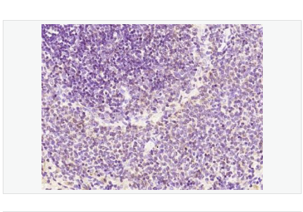 Anti-Phospho-Bcl2  antibody-磷酸化Bcl-2抗体,Phospho-Bcl2 (Ser87)