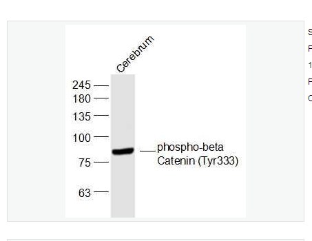 Anti-phospho-beta Catenin  antibody-磷酸化β-連環(huán)蛋白/β-連環(huán)素/β鏈接素抗體,phospho-beta Catenin (Tyr333)