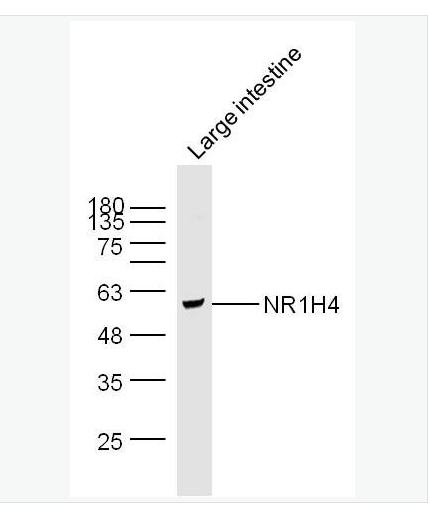 Anti-NR1H4 antibody-膽汁酸受體抗體,NR1H4