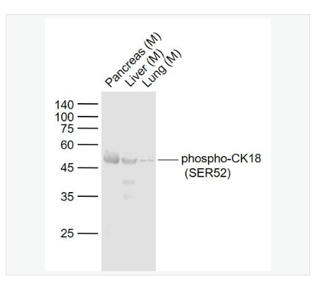 Anti-phospho-CK18  antibody-磷酸化细胞角蛋白18抗体,phospho-CK18 (Ser52)