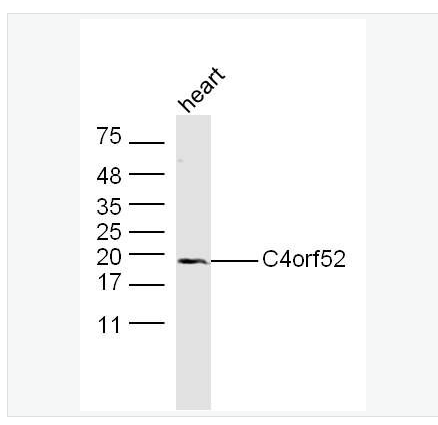 Anti-C4orf52 antibody-4號染色體開放閱讀框52抗體,C4orf52