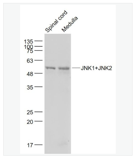Anti-JNK1+JNK2 antibody-氨基末端激酶1/2抗体,JNK1+JNK2