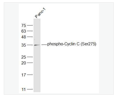 Anti-phospho-Cyclin C antibody-磷酸化周期素C抗体,phospho-Cyclin C (Ser275)
