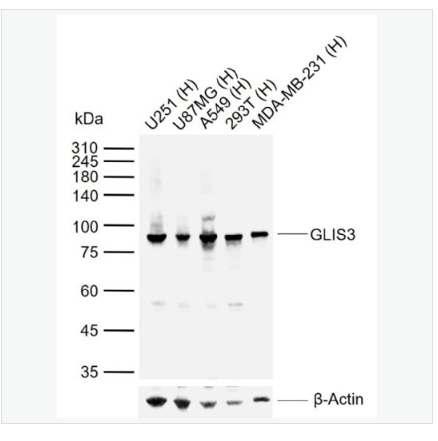 Anti-GLIS3 antibody-鋅指蛋白ZNF515抗體,GLIS3