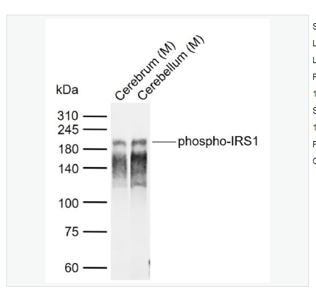 Anti-phospho-IRS1  antibody-磷酸化胰岛素受体底物1抗体,phospho-IRS1 (Ser616)