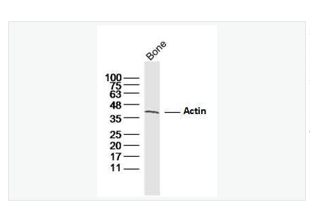 Anti-Actin  antibody-肌动蛋白α1抗体,Actin