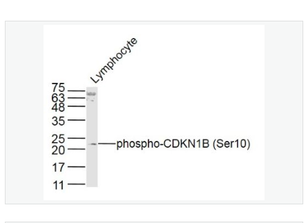 Anti-phospho-CDKN1B antibody-磷酸化P27抗体/周期素依赖激酶抑制剂,phospho-CDKN1B (Ser10)