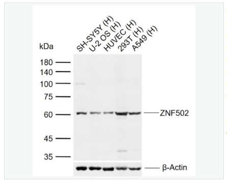 Anti-ZNF502 antibody-锌指蛋白502抗体,ZNF502