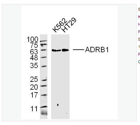 Anti-ADRB1 antibody-肾上腺素能受体β1抗体,ADRB1