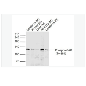 Anti-Phospho-FAK antibody  -磷酸化粘着斑激酶抗体,Phospho-FAK (Tyr861)