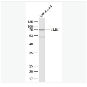 Anti-LIMK1  antibody  -单丝氨酸蛋白激酶1抗体,LIMK1