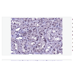 Anti-phospho-IKK beta  antibody  -磷酸化KB抑制蛋白激酶β抗体,phospho-IKK beta (Tyr188)