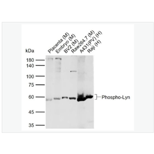 Anti-Phospho-Lyn  antibody  -磷酸化膜相关蛋白酪氨酸激酶Lyn抗体