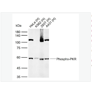 Anti-Phospho-PKR antibody  -磷酸化干扰素诱导的双链RNA活化蛋白激酶抗体