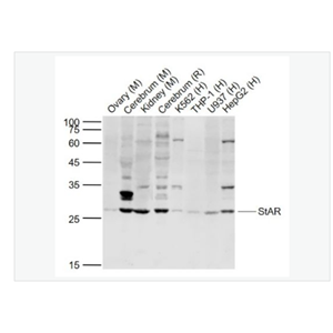 Anti-StAR antibody  -促黄体激素诱导蛋白抗体
