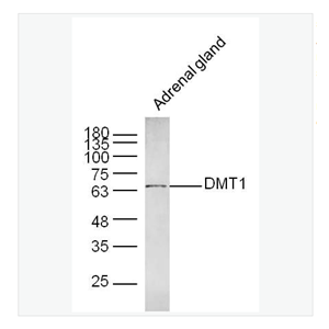 Anti-DMT1antibody  -金属离子转运体1抗体,DMT1