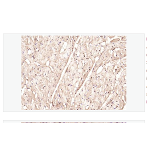 Anti-phospho-STAT3 antibody  -磷酸化信号转导和转录激活因子3抗体