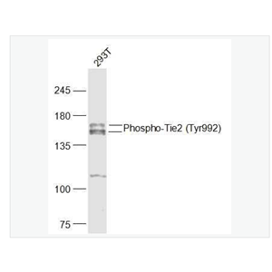 Anti-Phospho-Tie2 antibody  -磷酸化血管生成素受体2抗体