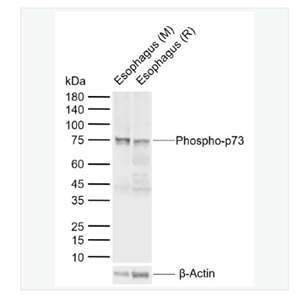 Anti-Phospho-p73 antibody  -磷酸化肿瘤蛋白P73抗体