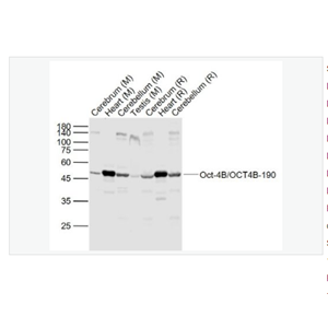 Anti-Oct-4B/OCT4B-190 antibody  -胚胎干细胞关键蛋白190抗体(N端)