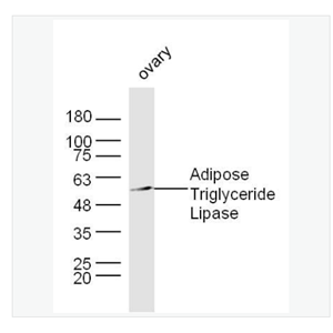 Anti-Adipose Triglyceride Lipase antibody  -脂肪甘油三酯脂酶抗体,HAdipose Triglyceride Lipase