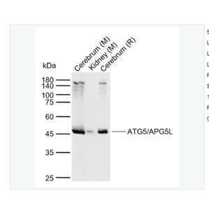 Anti-ATG5/APG5L antibody  -自噬蛋白5/细胞凋亡的特异性蛋白抗体