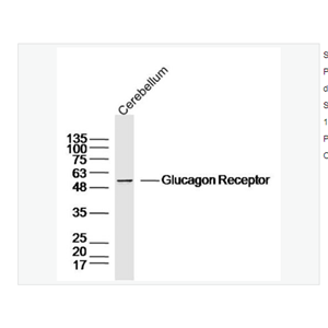 Anti-Glucagon Receptor  antibody  -胰高血糖素受体抗体