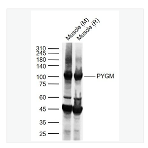 Anti-PYGM antibody  -肌肉糖原磷酸化酶抗体
