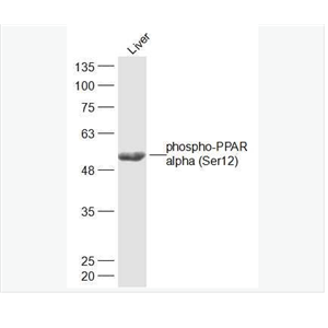 Anti-phospho-PPAR alpha antibody  -磷酸化α型-过氧化酶活化增生受体抗体