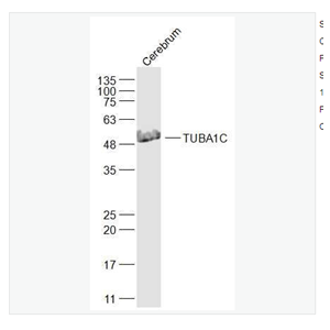 Anti-TUBA1C antibody  -微管相关蛋白α6抗体