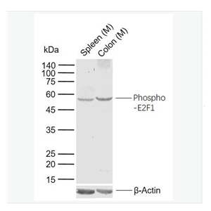 Anti-phospho-E2F1 antibody  -磷酸化转录因子E2F-1抗体