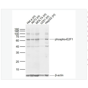 Anti-phospho-E2F1  antibody  -磷酸化转录因子E2F-1抗体