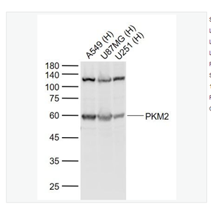 Anti-PKM2  antibody  -丙酮酸激酶-M2抗体