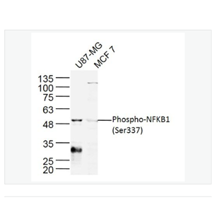 Anti-Phospho-NFKB1  antibody  -磷酸化细胞核因子p50/k基因结合核因子抗体