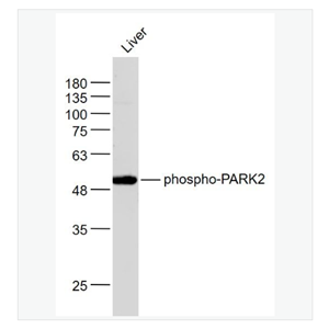 Anti-phospho-PARK2  antibody  -磷酸化帕金蛋白抗体