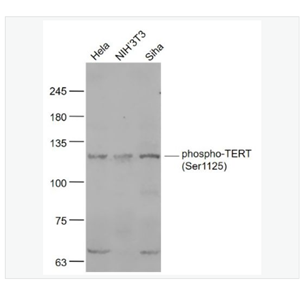 Anti-phospho-TERT  antibody  -磷酸化端粒酶逆转录酶抗体