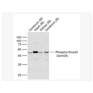 Anti-Phospho-Smad3  antibody  -磷酸化细胞信号转导分子SMAD3抗体