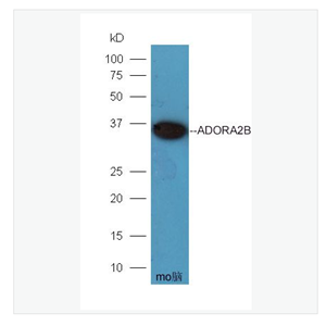 Anti-ADORA2B antibody-腺苷A2b受体/神经生长因子1受体抗体