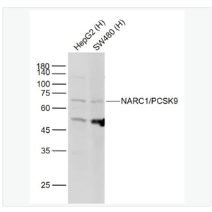 Anti-NARC1/PCSK9 antibody-神经细胞凋亡调节转化蛋白1/前蛋白转化酶枯草溶菌素9抗体