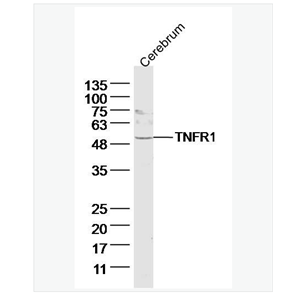 Anti-TNFR1 antibody-肿瘤坏死因子受体1抗体