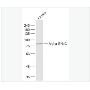 Anti-Alpha-ENaC antibody-钠通道蛋白α 抗体,Alpha-ENaC