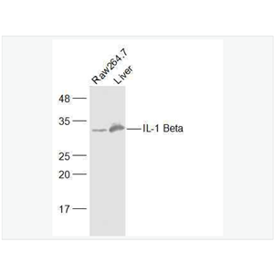 Anti-IL-1 Beta antibody-IL-白介素1β抗体,IL-1 Beta