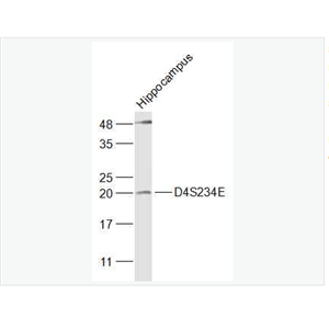 Anti-D4S234E antibody-NEEP21蛋白抗体