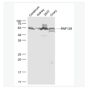 Anti-RNF128 antibody-环指蛋白128抗体