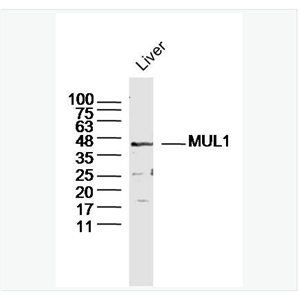 Anti-MUL18 antibody-E3泛素连接酶MUL1抗体