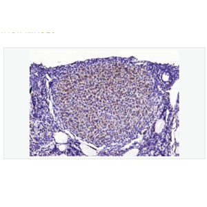 Anti-phospho-STMN1 antibody-磷酸化原癌基因蛋白18抗体